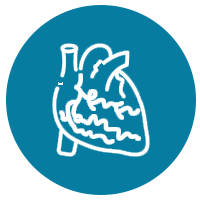 Angioplasty