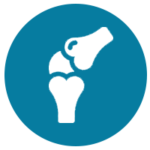 Knee Replacement